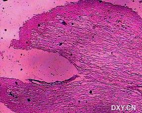 尸检 8：死亡赠品,揭秘死亡背后的神秘赠品之谜